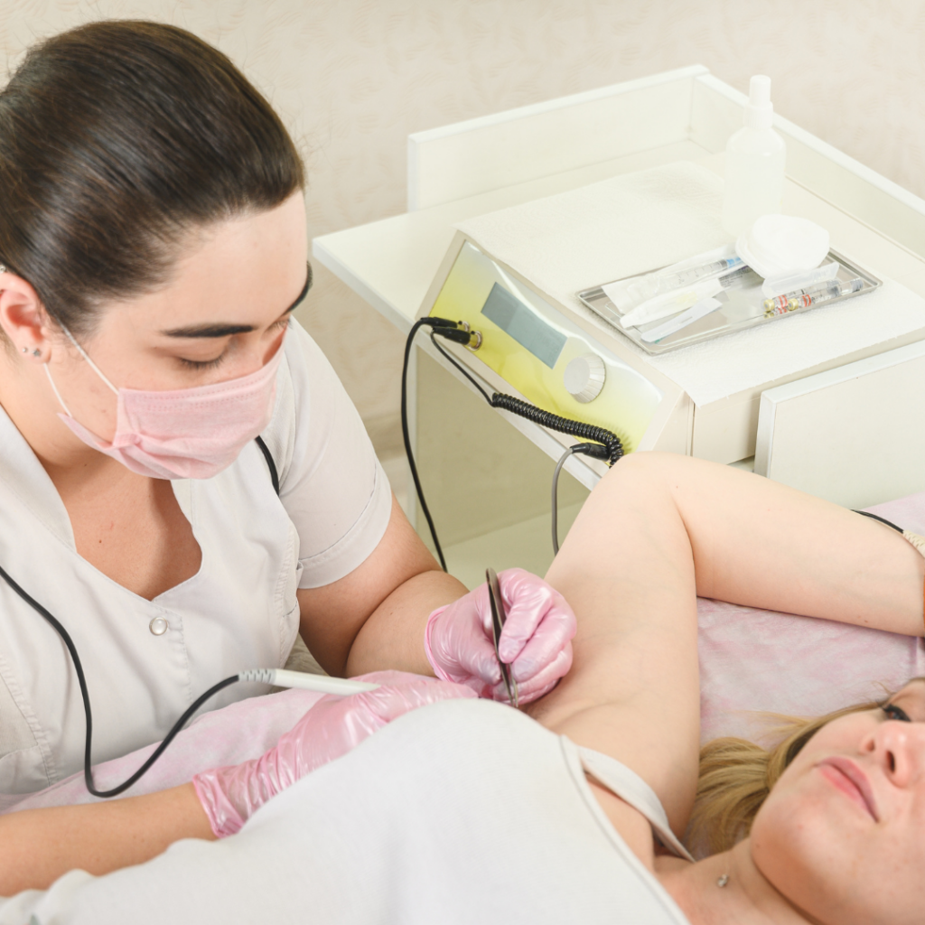 Removal of Hair Permanently in a Woman's Armpits Using Electrolysis.