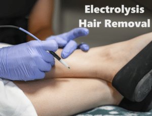 Electrolysis Dallas TX treatment at Olysis Med Spa